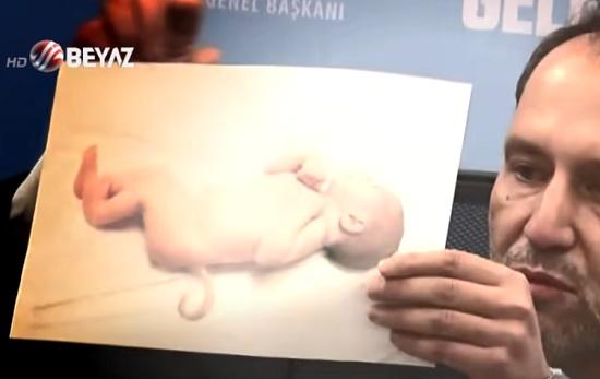 Gruwelijke beelden van pasgeboren baby’s met één oog en staart, misvormd door ‘vaccins’